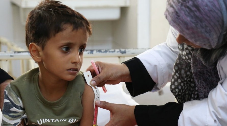 Thousands of Children are At Risk of Death in Yemen Due to Lack of Food