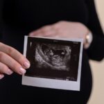 Ultrasound Scan – Everything You Need to Know